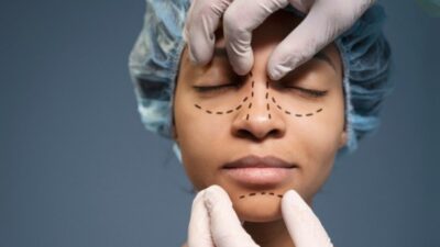 Chirurgen für Blepharoplastik in Deutschland
