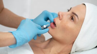 Top 10 der Lippenauffüller in Deutschland