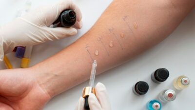 Die 10 besten Allergologen in Deutschland