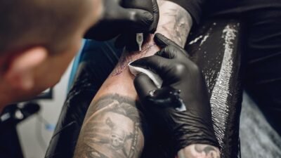 Die 10 besten Tattooentfernungs-Zentren in Deutschland