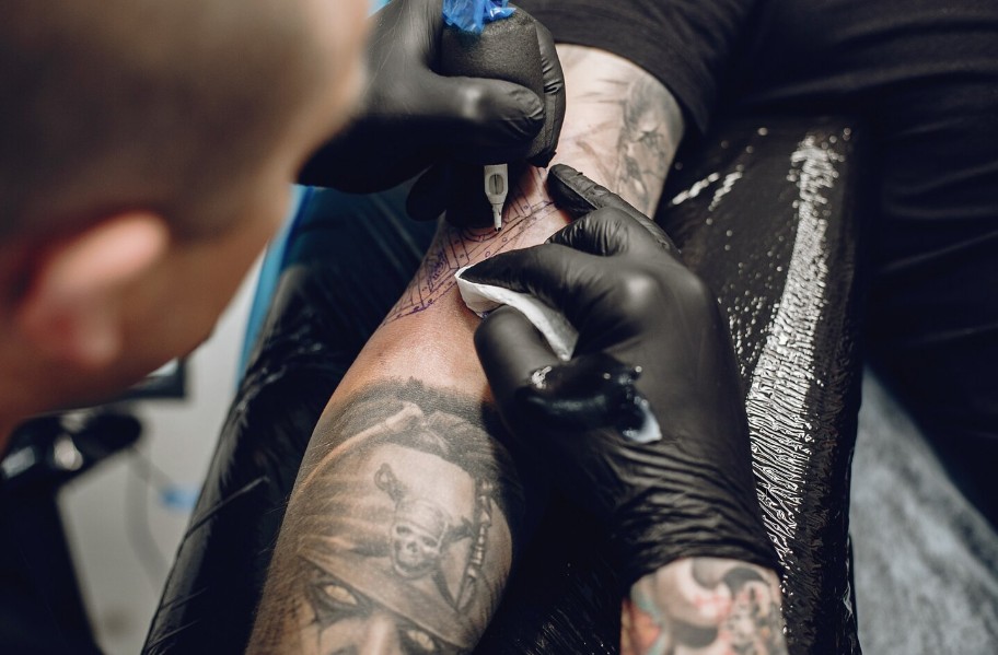 Die 10 besten Tattooentfernungs-Zentren in Deutschland